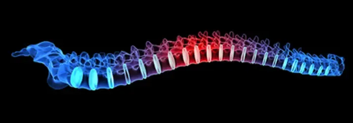 A 3D rendering of a human spine with color gradients, illustrating spinal anatomy and possible pain areas.