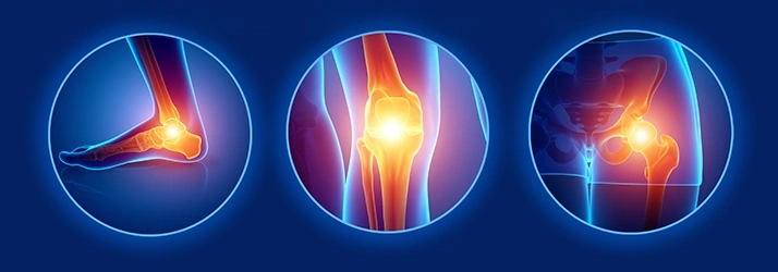 Digital illustration showing highlighted pain points in the ankle, knee, and hip joints.